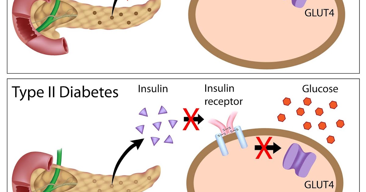 Blood Sugar Symptoms How To Control Fasting Blood Sugar blood-sugar-symptoms-how-to-control-fasting-blood-sugar