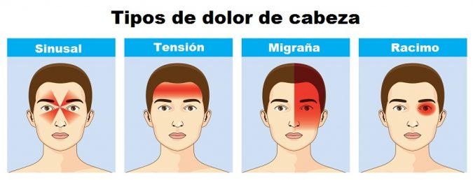Tipos y ubicaciones de dolores de cabeza Tipos y ubicaciones de dolores de cabeza