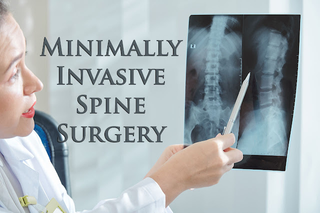 What Is Minimally Invasive Spine Surgery El Paso Texas