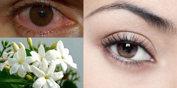 Cara Ampuh Untuk Jernihkan Mata Merahmu, Hanya dengan Bahan Alami Ini Cara Ampuh Untuk Jernihkan Mata Merahmu, Hanya dengan Bahan Alami Ini