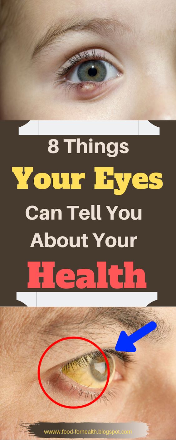 8 Things Your Eyes Can Tell You About Your Health