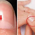 Γνωρίζετε τι δείχνει το άσπρο ημικύκλιο στα νύχια σας;