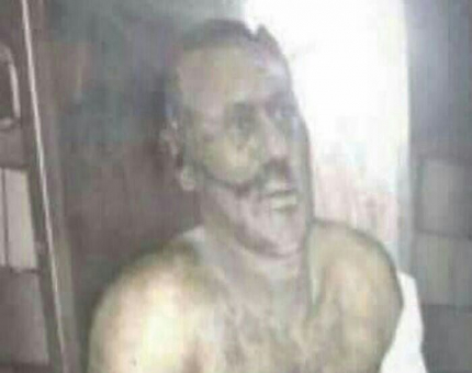 صوره علي عبدالله صالح بعد مقتلة صوره علي عبدالله صالح بعد مقتلة