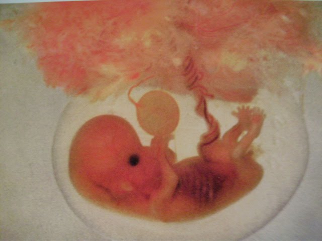 Human embryo in amniotic sac