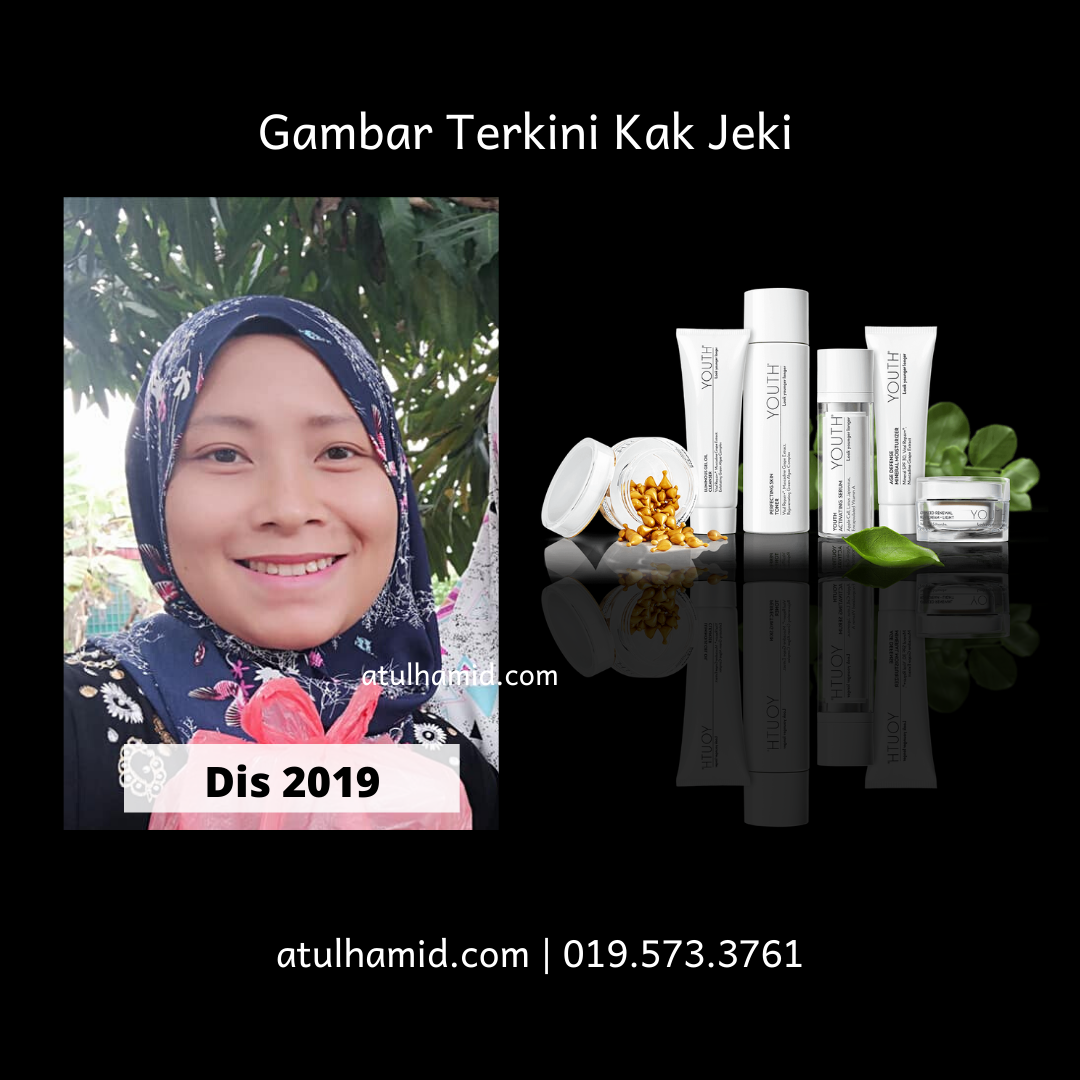 Testimoni Youth Skincare: Masalah Kulit Jerawat Tiada Lagi