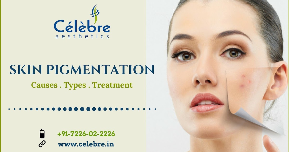 Skin Pigmentation Causes, Types and Treatment