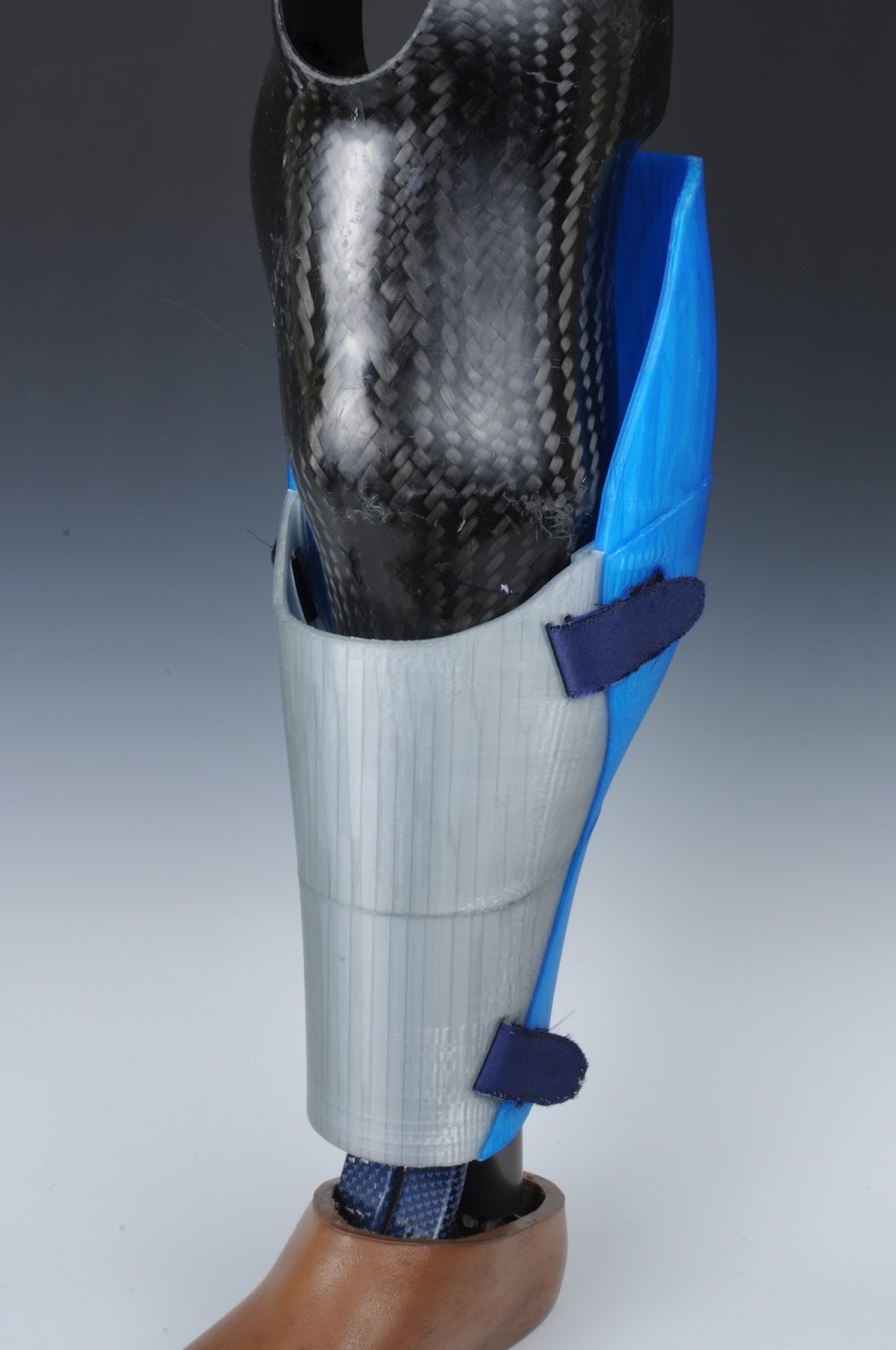 Next step prosthesis image