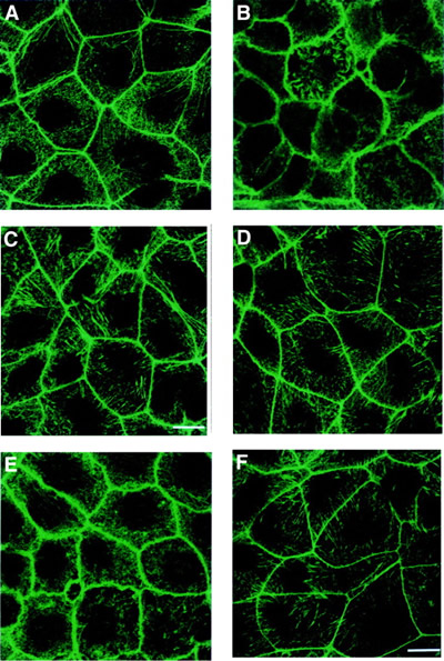 Fluorescent Staining of Cytoskeletal Elements
