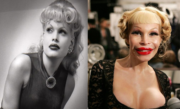 Transsexual amanda lepore silicone injections photo 17
