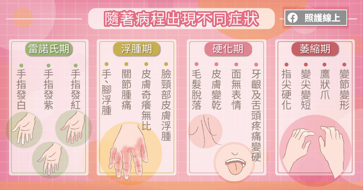 硬皮症會隨著病程出現不同症狀