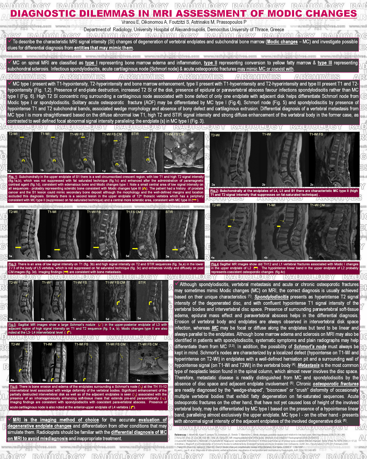 Radiology Archives: Dilemmas in MRI Assessment of Modic Changes
