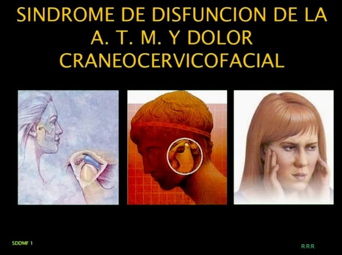 DTM: Síndrome de dolor y disfunción de la ATM - Mtro. Rafael Ruiz Rodriguez