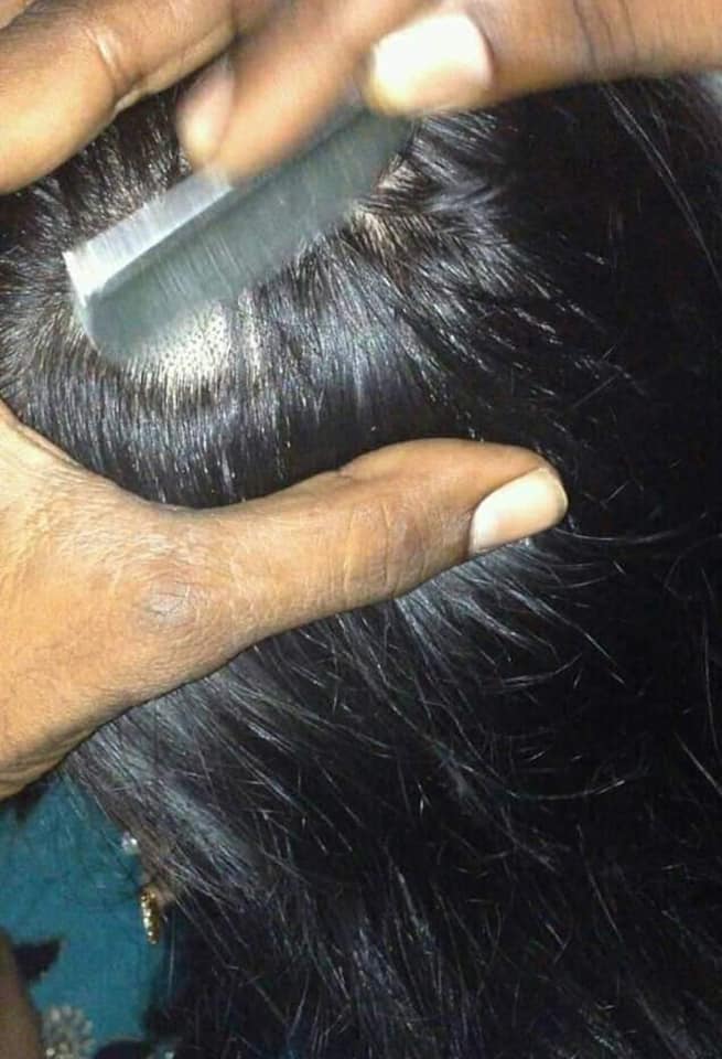 Village Barber Stories Home made head shaving for removing Dandruff