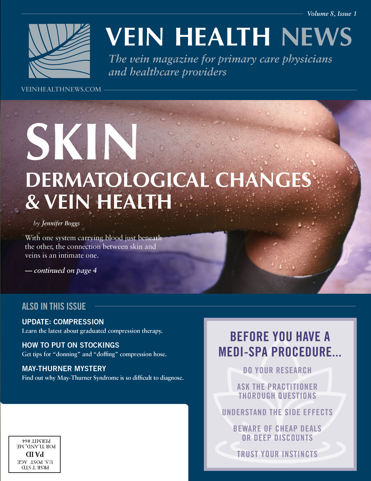 Hidden Vein Health Crisis This Affects 4 In 10 Americans - ibhpobh