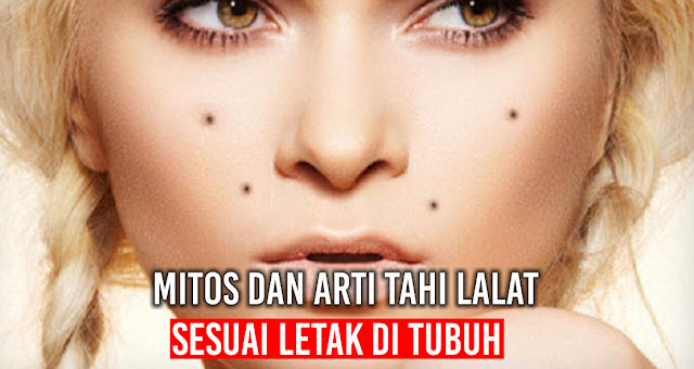 Mitos dan Arti Tahi Lalat Sesuai Letak di Tubuh