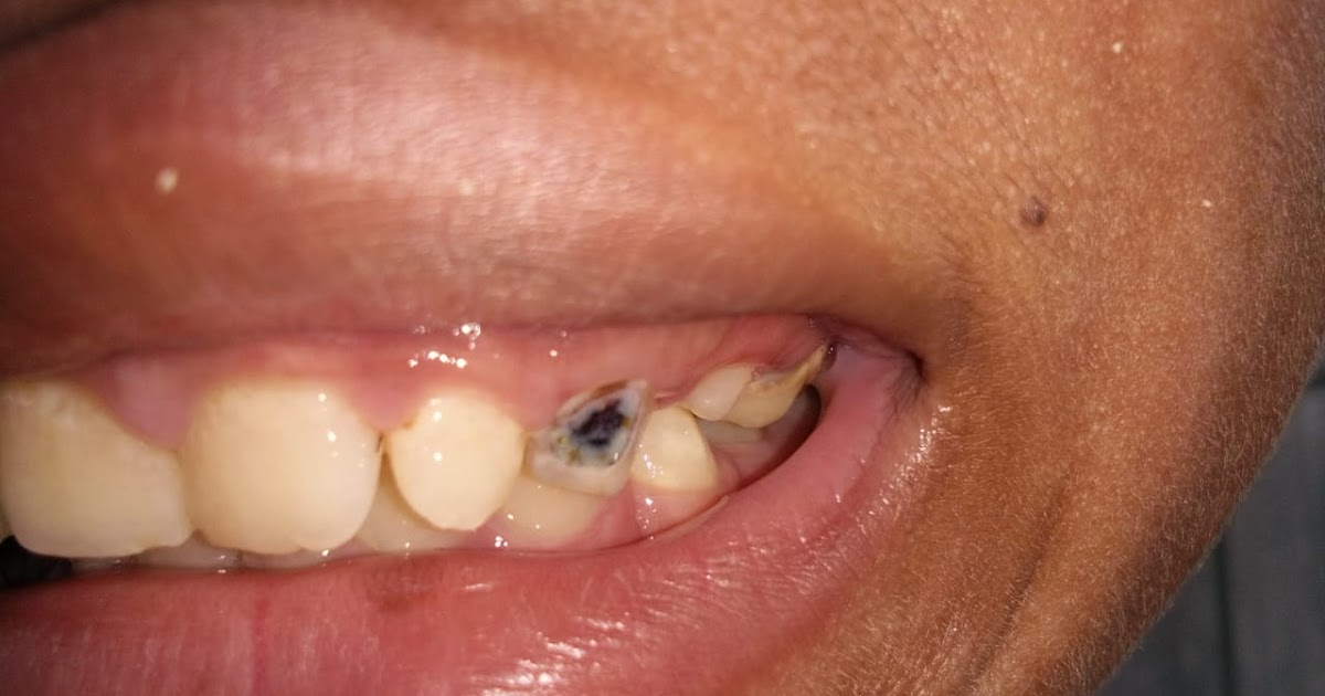 contoh gambar gigi lengkap