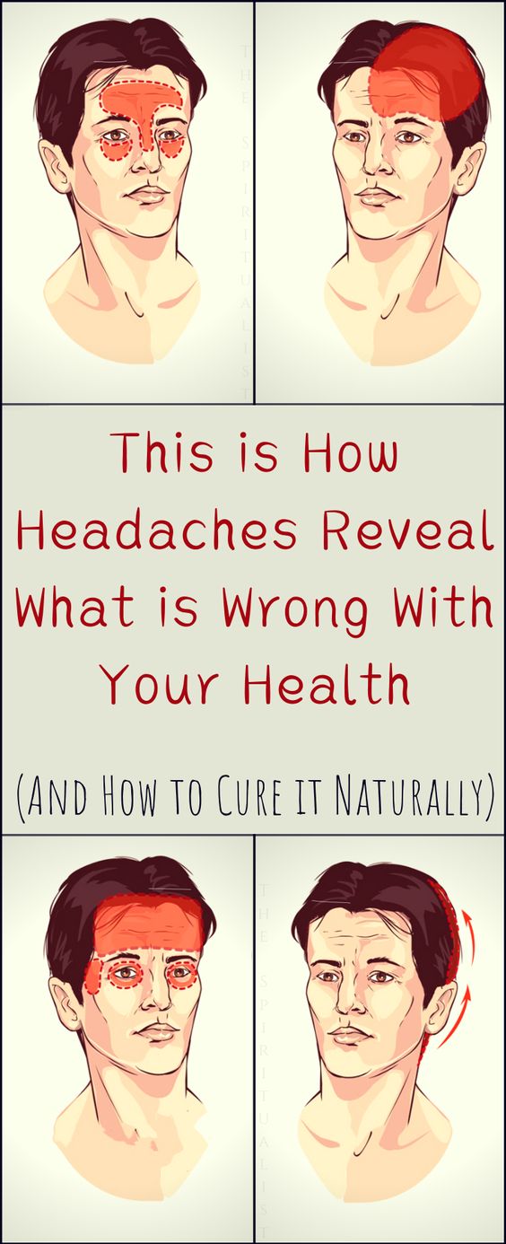 4 Most Usual Types of Headaches (What They Indicate About Your Health