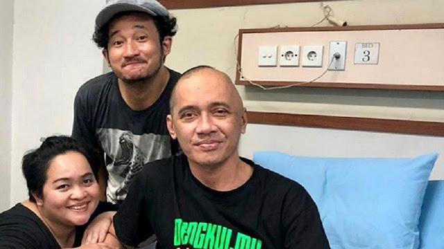 Agung Hercules Meninggal