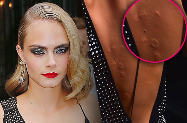 Cara delevingne leaked pics