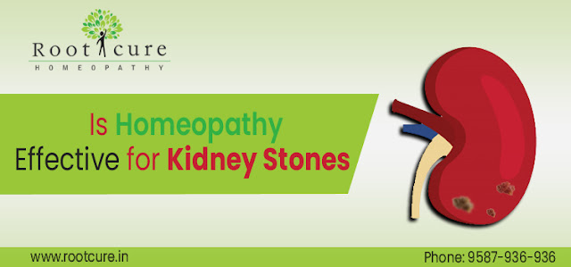 Best Homeopathic Doctor in Jaipur-Rootcure Homeopathy