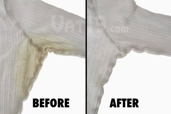 Remove All Stains How To Yellow From Remove All Stains How To Yellow From