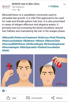 Telogen Effluvium Treatment Telogen Effluvium Treatment