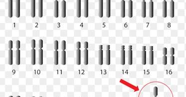Jenis Jenis Mutasi Kromosom Aberasi Biologine Pak Mycunk The