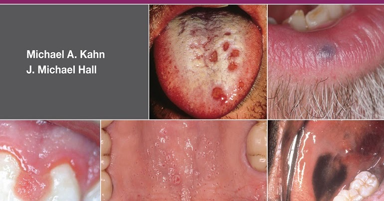 The ADA Practical Guide to Soft Tissue Oral Disease 2nd Edition