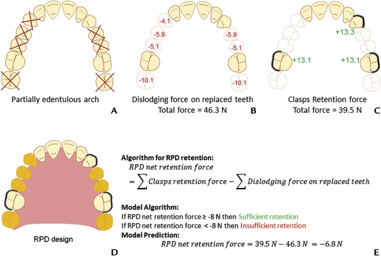 Partial denture design (11)