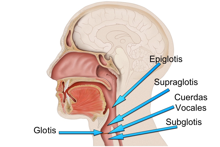 Es de que glotis edema una
