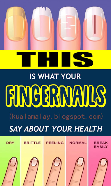 This Is What Your Fingernails Say About Your Health Health And Wellness