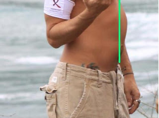 barriga-inchada-dura.JPG