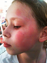 acrylic paint face toxic skin non painting rash acrylics reactions any safe using poster bad paintertainment craft paintings faq paints