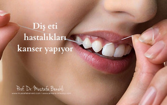 DİŞ ETİ HASTALIKLARI KANSER YAPIYOR Prof. Dr. Mustafa Benekli Tıbbi
