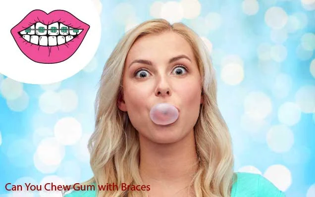 High-Quality Can You Have Sugar Free Gum With Braces Design Collection