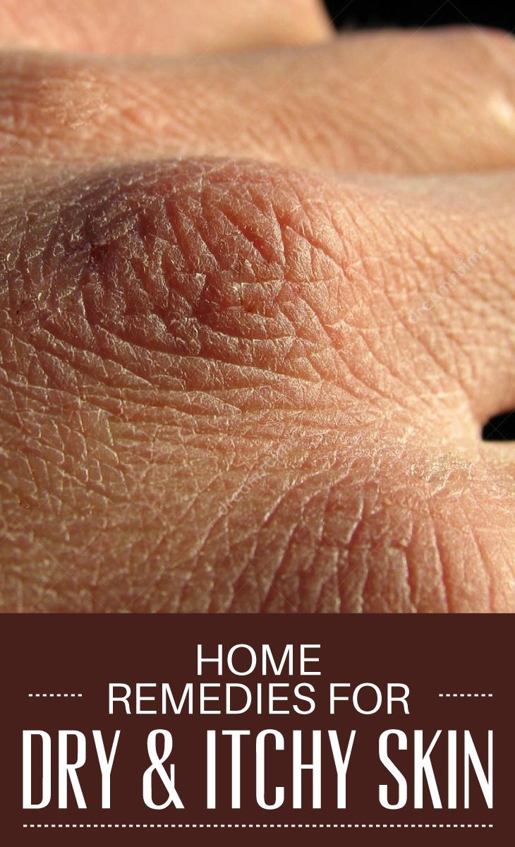 5 Best Home Remedies for Dry Itchy Skin