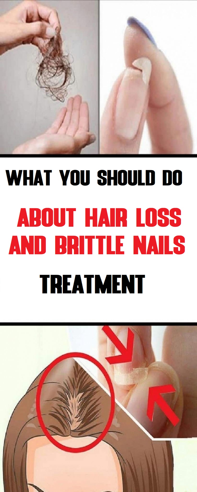 What You Should Do About Hair Loss and Brittle Nails Treatment