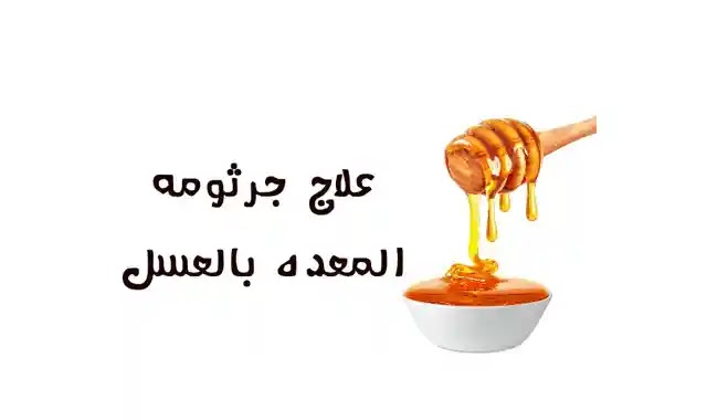 فوائد العسل لجرثومة المعده