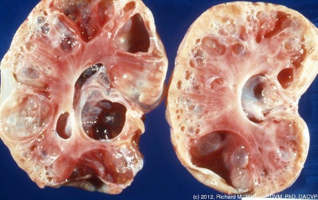 Tanpa Kita Sadari, Inilah Gejala Awal Penyakit Gagal Ginjal, Kenali Ciri-Cirinya Sebelum Terlambat ciri ciri%2Bgagal%2Bginjal