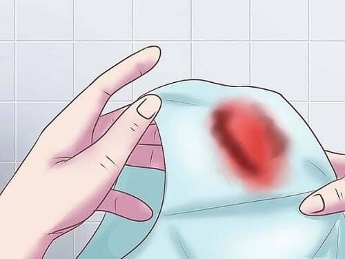 ra máu sau khi nạo hút thai