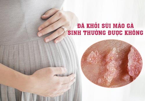 đã khỏi sùi mào gà có nên sinh thường