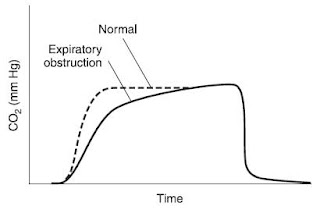 Effect of airway obstruction on the capnograph