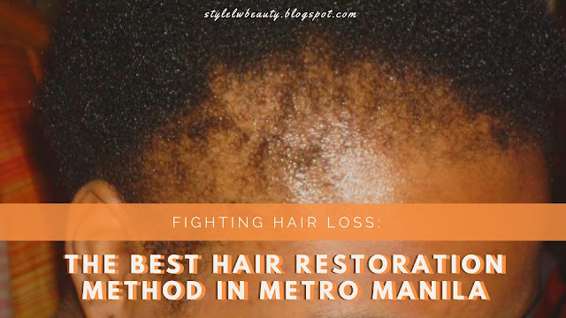 best hair restoration method in metro manila