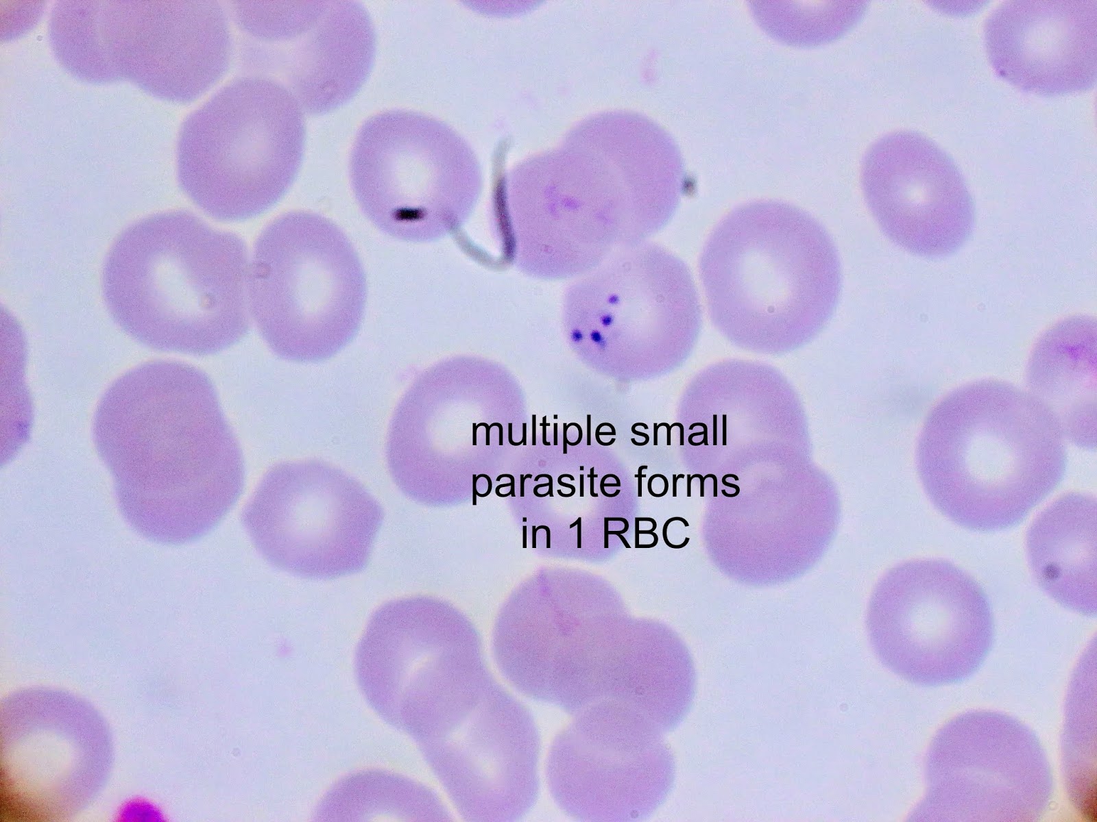 intraerythrocytic paraziták)