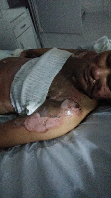 A jovem está internada na UTI de um hospital da capital e o estado de saúde é gravíssimo