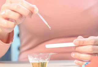 Urine Pregnancy Test CPT Code