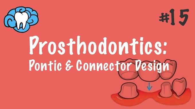 PROSTHODONTICS: Pontic & Connector Design