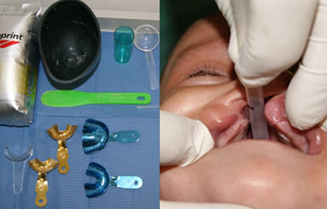 (c) Odontologiavirtual.com