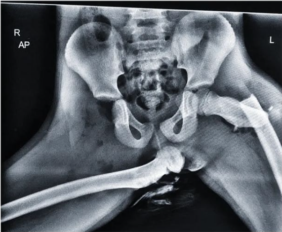 An X-Ray of Horrific Injuries