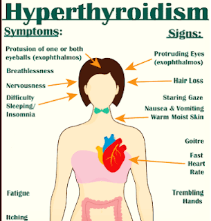 HYPERTHROIDISM: Causes, Signs, Symptoms, and Treatment.